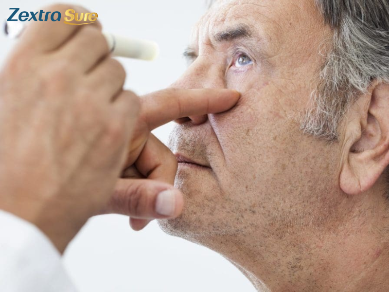 can-cataracts-come-back (5)